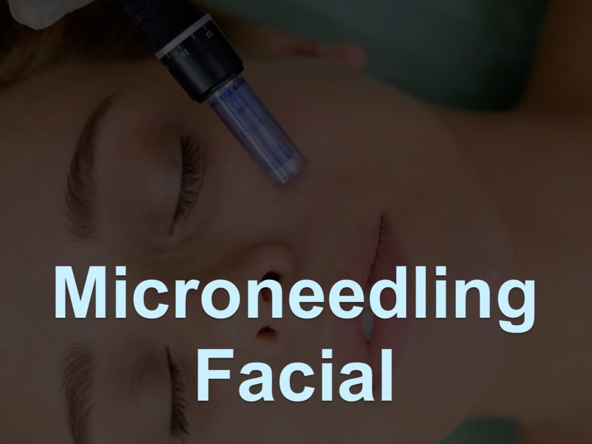 Microneedling Facials