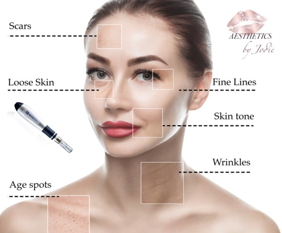 Anti Wrinkle Injection Treatment Areas 2022
